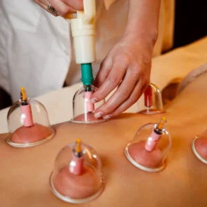 Massage + ventouses + Hijama humide (Sounnah)