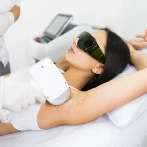 Épilation à la Lumière Pulsée (IPL)